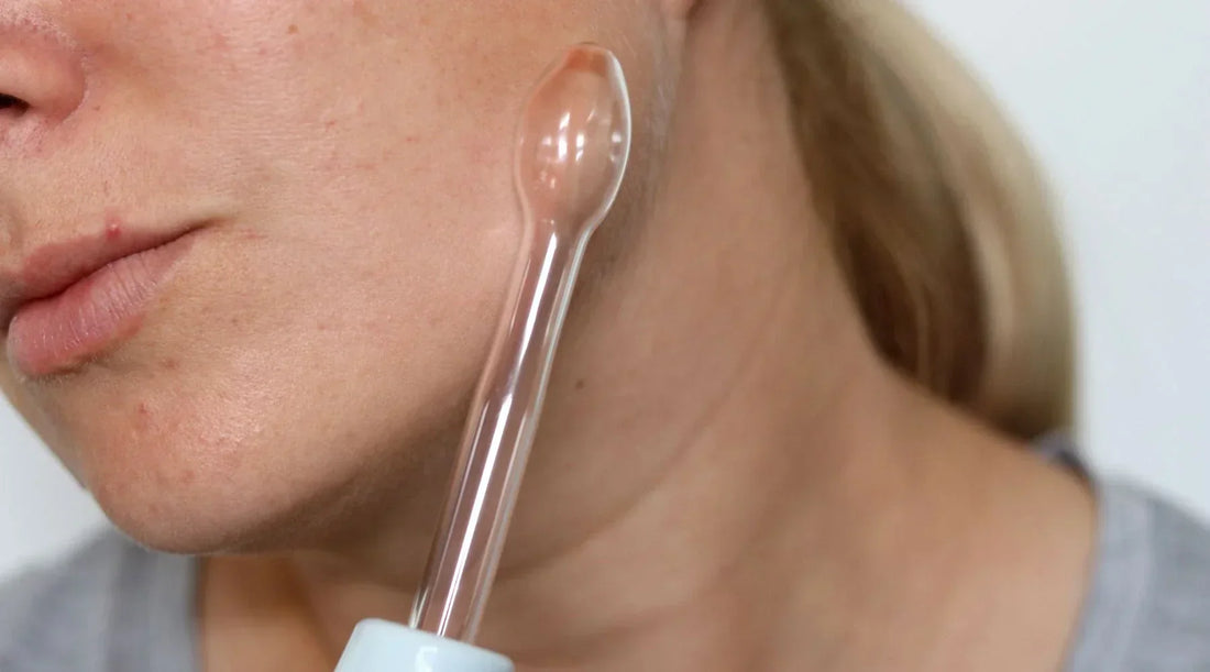 Woman using a high frequency wand as an acne treatment solution