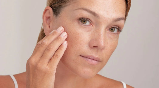 Woman with skin pigmentation