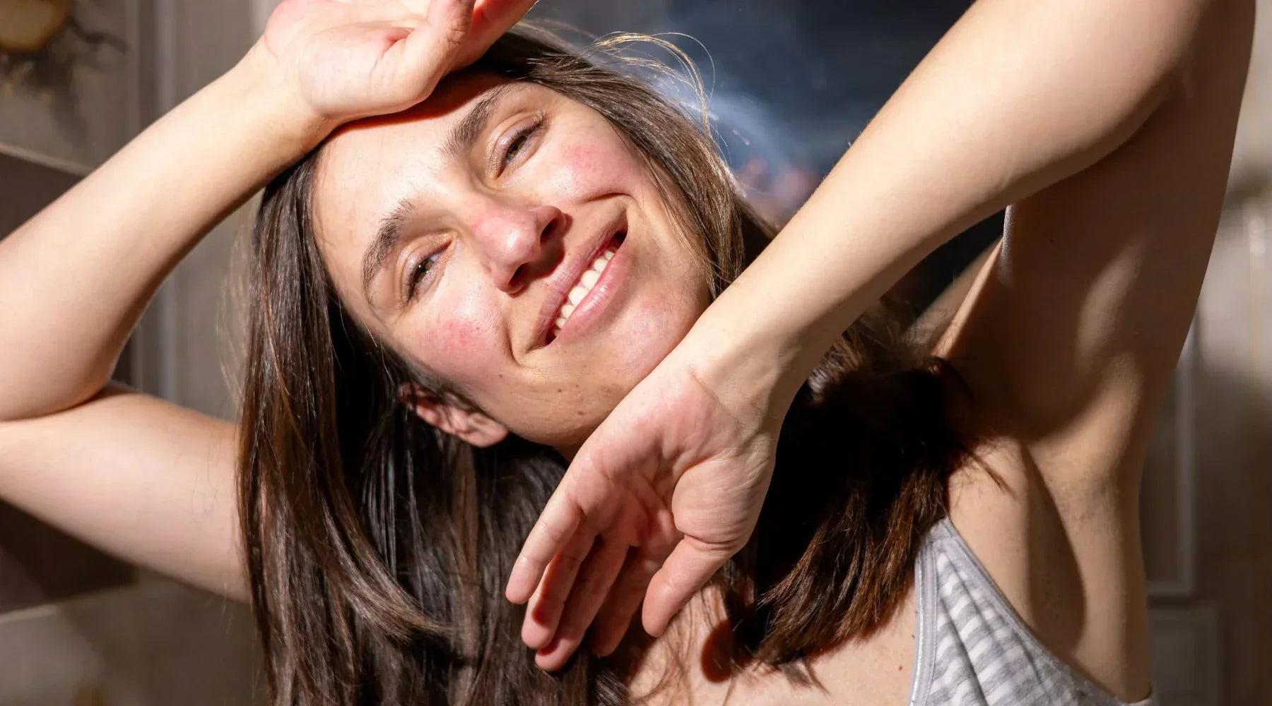 Woman with natural remedies and home treatments for rosacea symptoms
