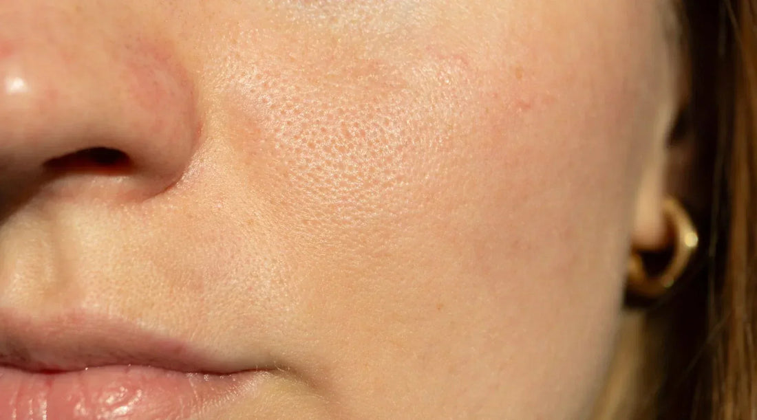 Close-up of smooth skin after minimizing enlarged pores