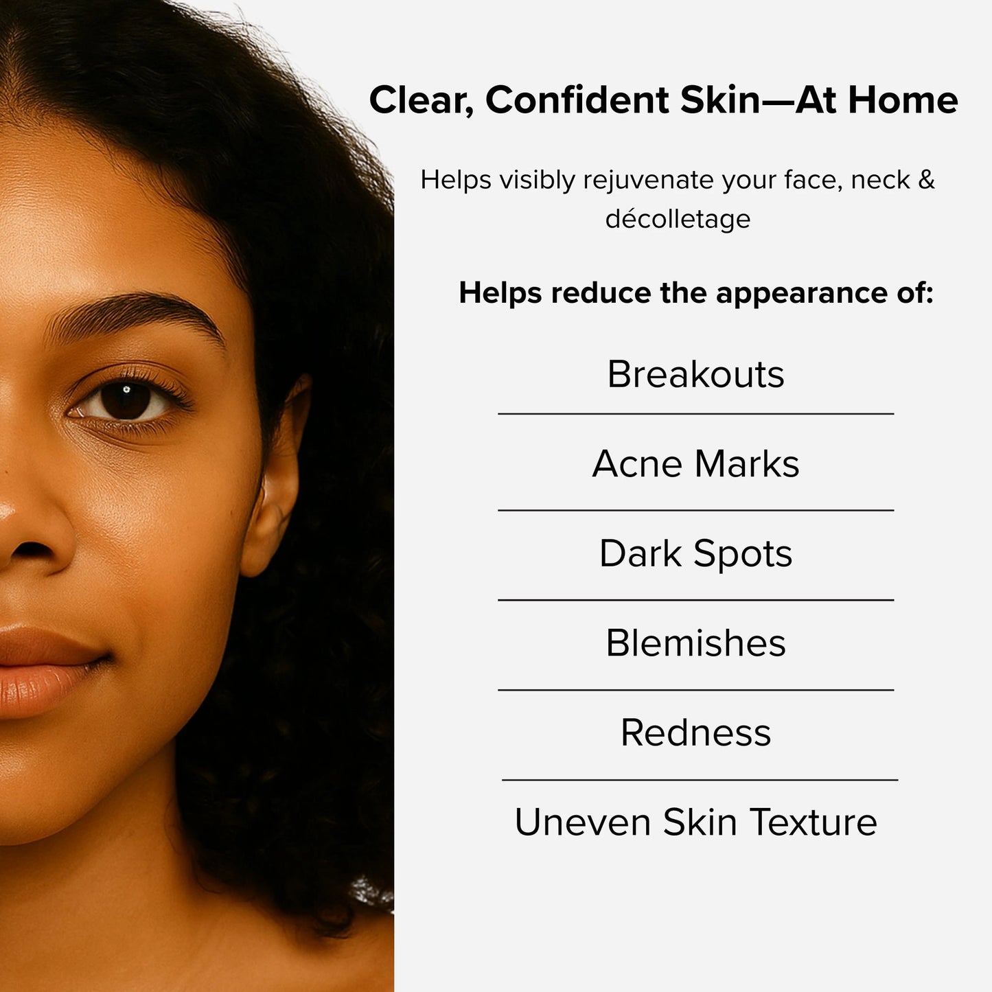 HighWand Clear™ – Acne Treatment